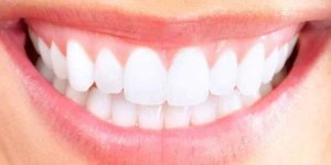 Le blanchiment des dents : un cadeau pour Votre sourire